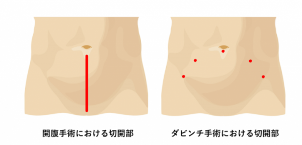 図解の画像